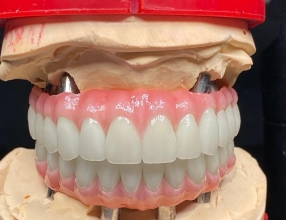 FDA认证英国义齿加工厂,义齿公司,假牙加工厂