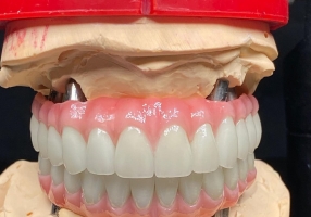 FDA认证英国义齿加工厂,义齿公司,假牙加工厂