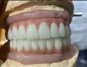 多伦多义齿加工厂,义齿公司,假牙加工厂