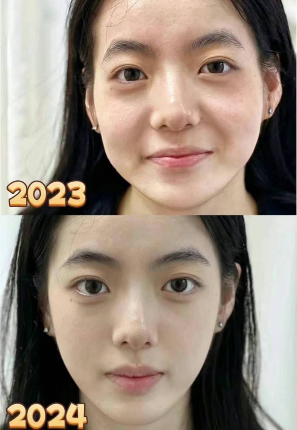 多伦多医美