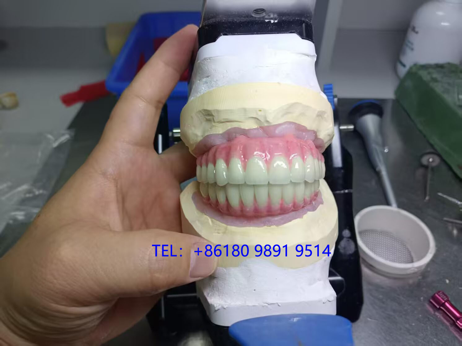 深圳义齿加工厂，支持UPS/DHL直发，生产周期短至3天