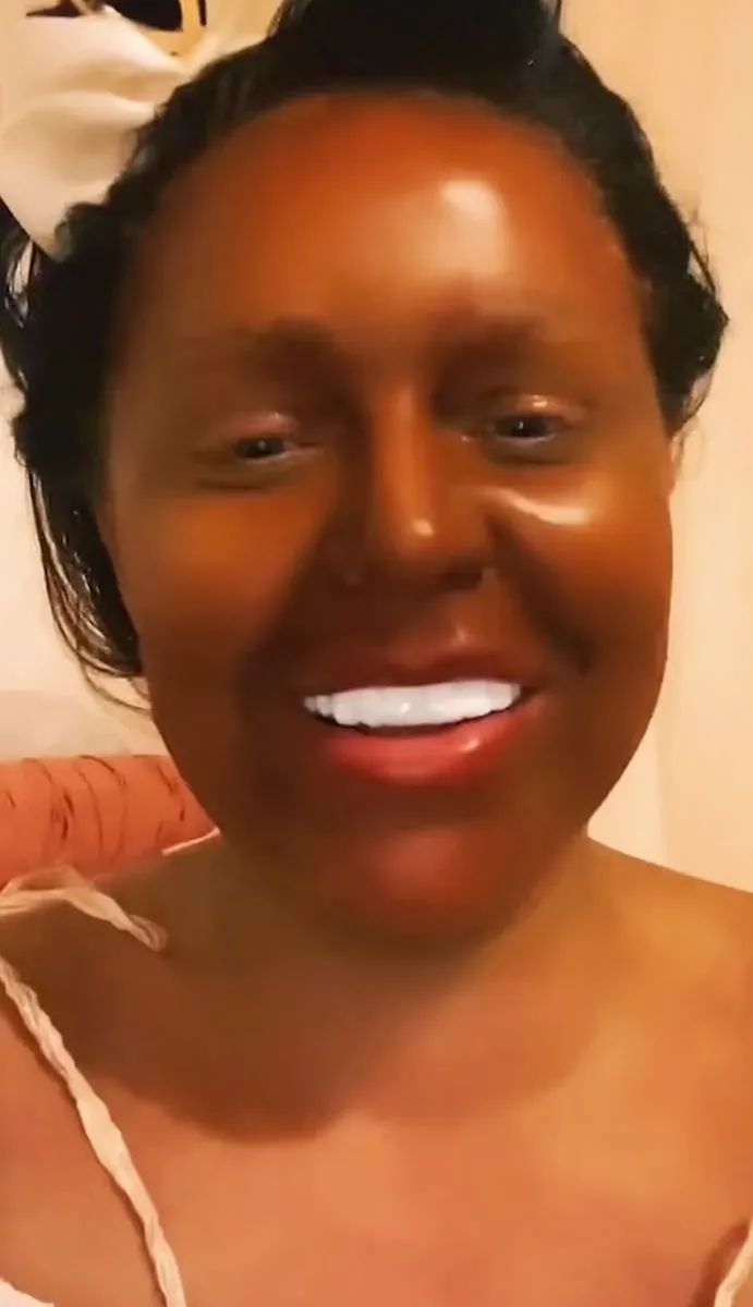 妹子美黑时突发奇想:晒黑咋样?结果悲剧了(组图)