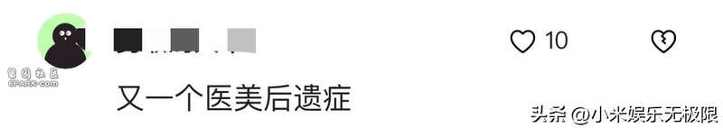 49岁林心如大变样 脸超肿 连酒窝都快填满了(组图)