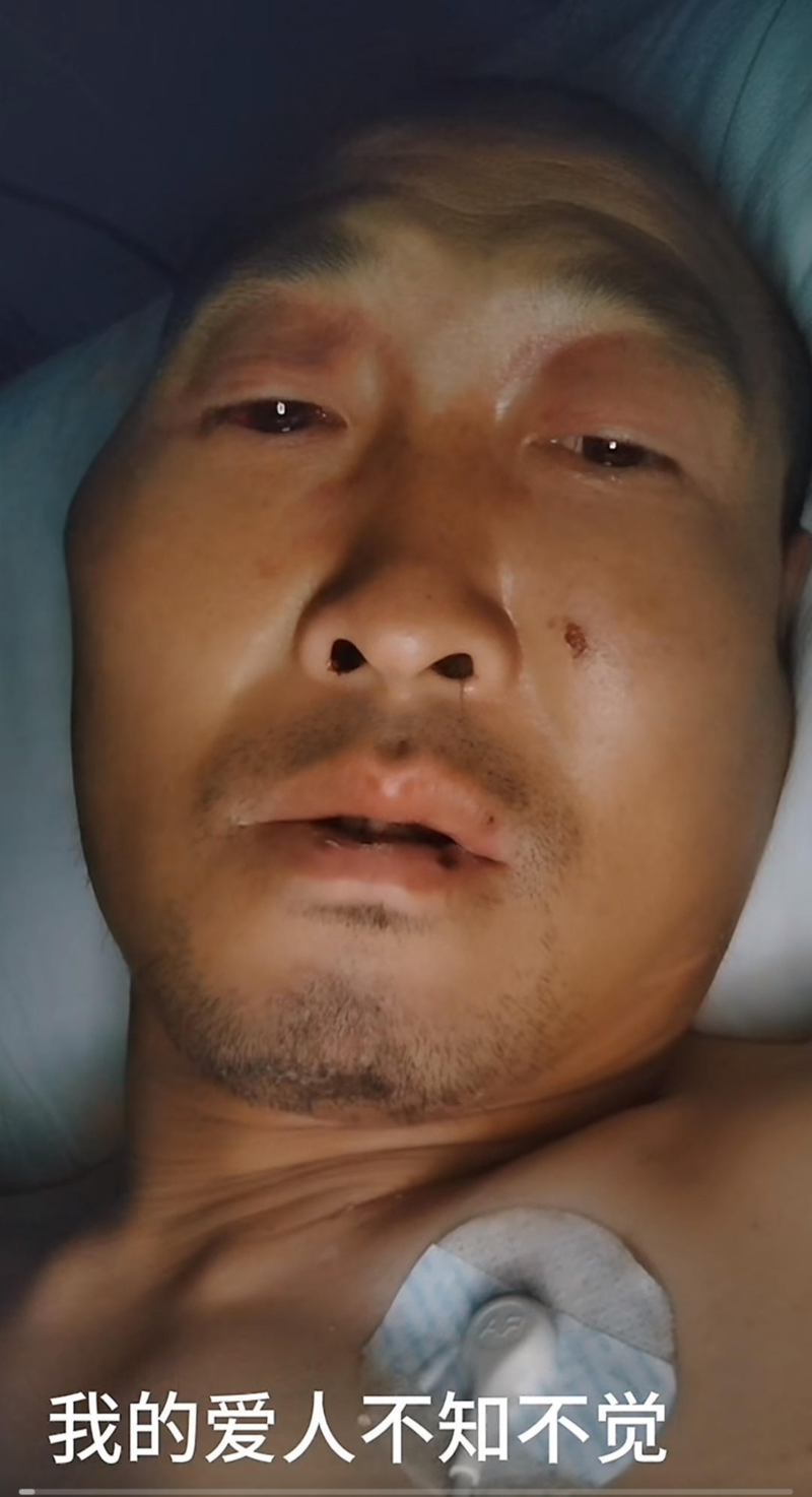 高空杂技演员表演时坠地:已出院 落泪悼念坠亡妻子(图)