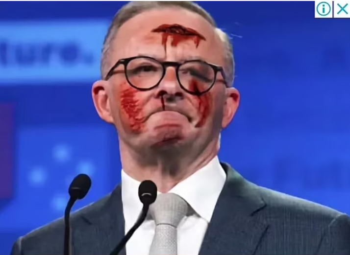 圣诞节当天 澳洲总理满脸是血 照片刷屏全澳(组图)