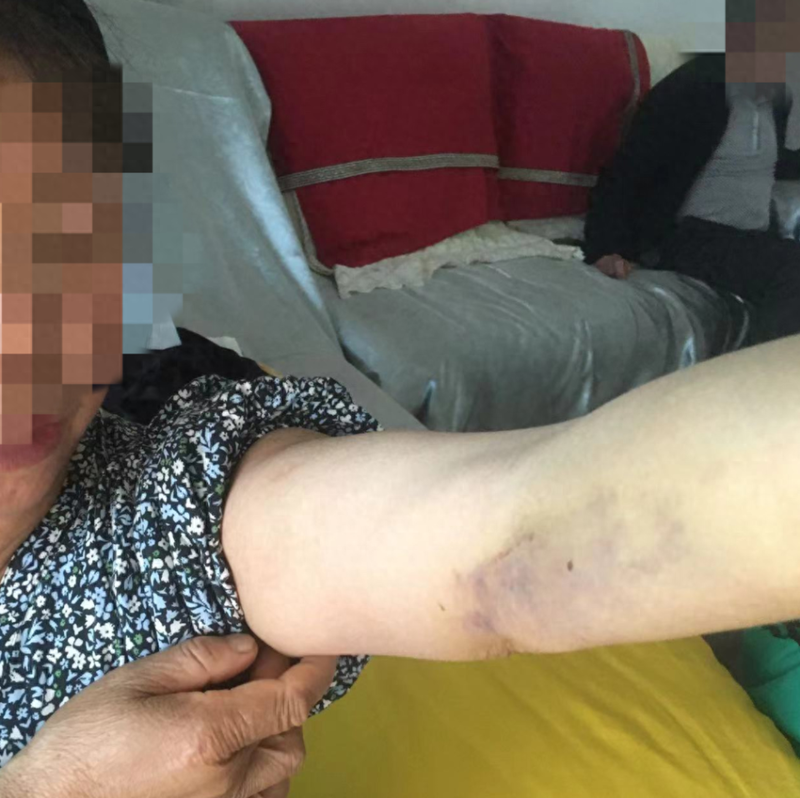 女子去赌场讨债被警方当赌徒拘10日 被踹折3根肋骨(图)