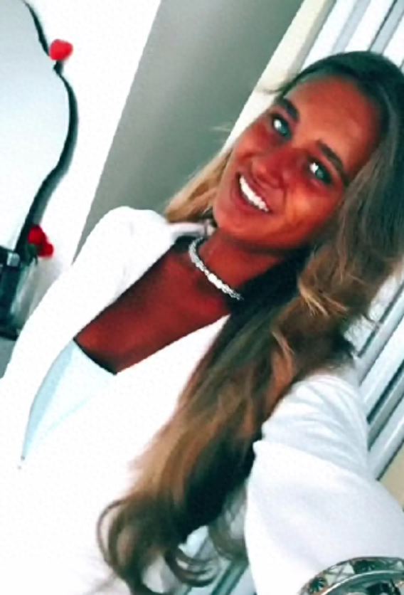 18岁白人女孩沉迷“美黑”,2年晒成“烧焦的薯片”(图)