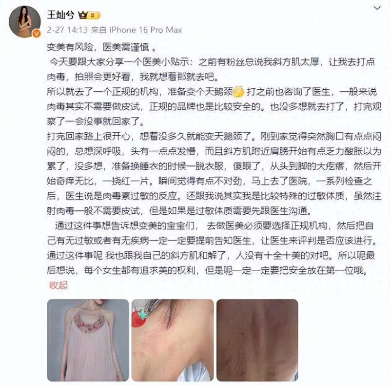 杜淳妻子王灿医美“翻车” 背部疙瘩触目惊心(组图)