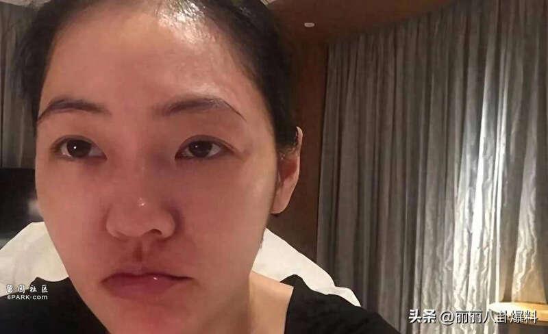 小S深夜入院若为真,极有可能和那桩陈年旧事有关 (图)