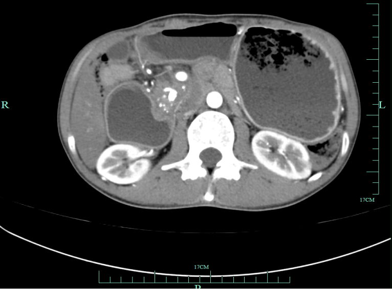确诊“癌王”!男子:我不沾烟酒啊 医生:这事做错了(图)