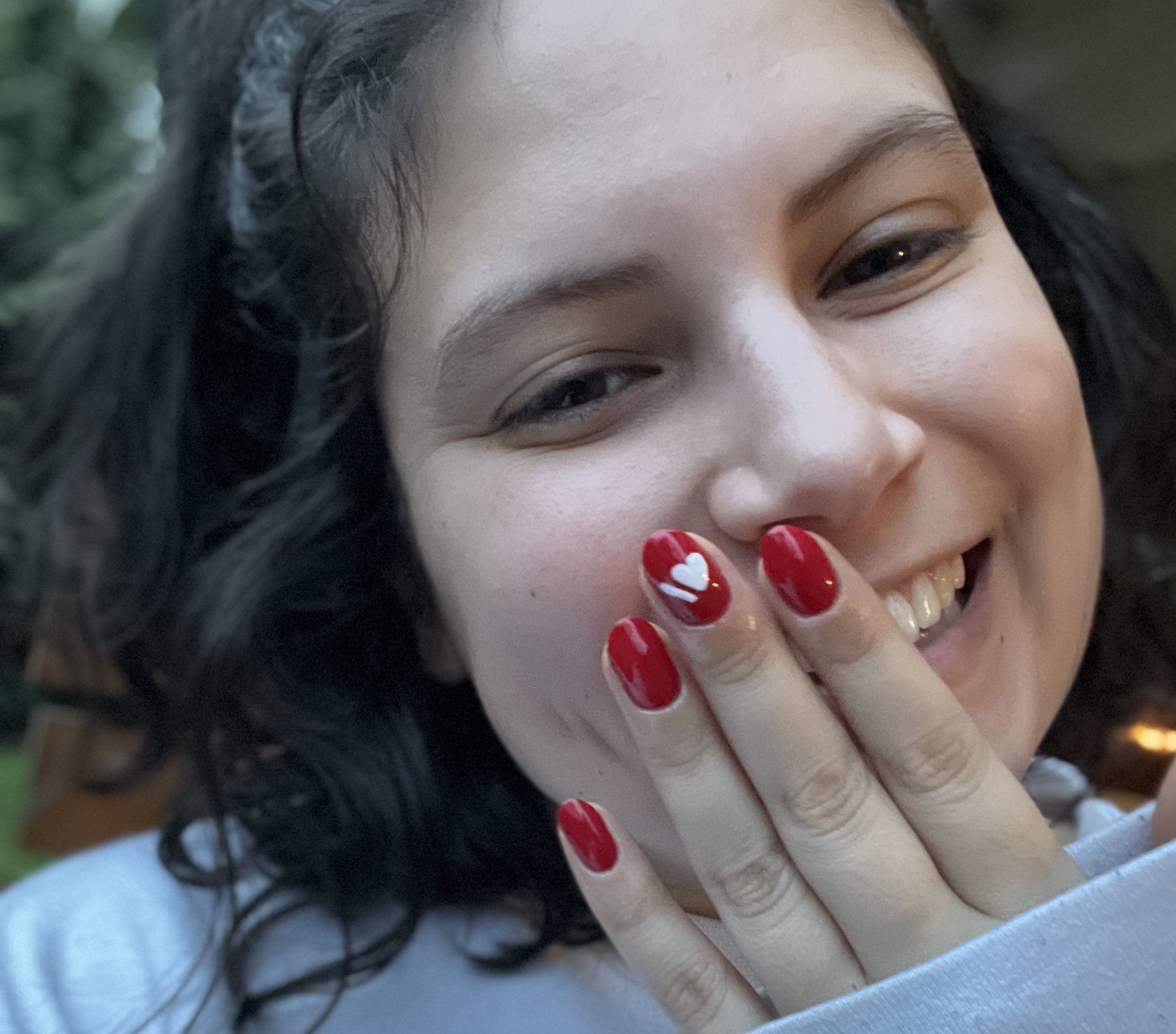 公元前一位女士认为这个缩写词在中风后挽救了她的生命