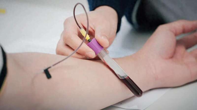 高油高盐的血管长这样,很多人看完再也不敢乱吃了(图)