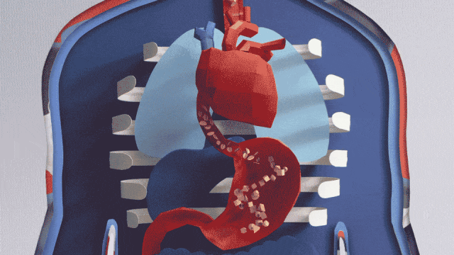 小心了!好好的一个胃,是怎样一层层坏掉、破洞的?(组图)