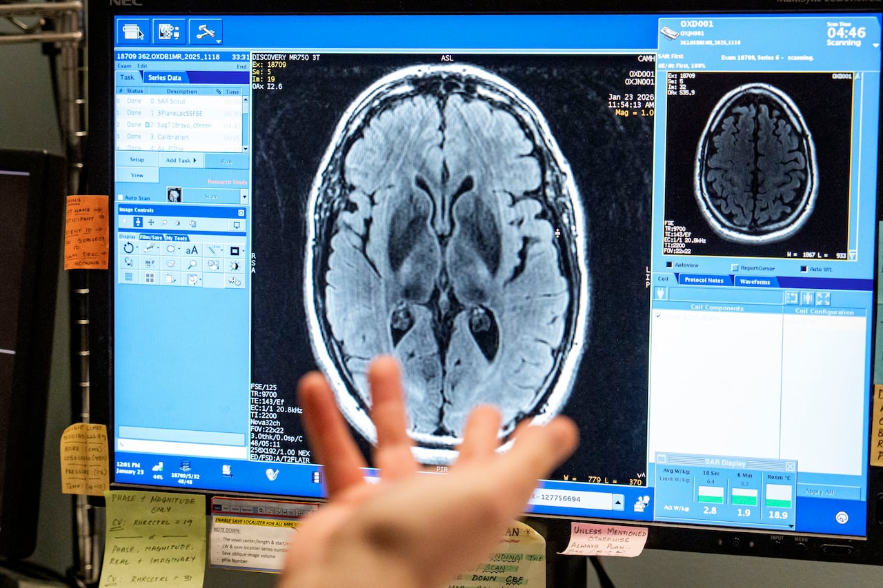 Researchers watch real-time data coming in from an MRI on Brendan Hynes's brain. Computer screen shows brain scan image.