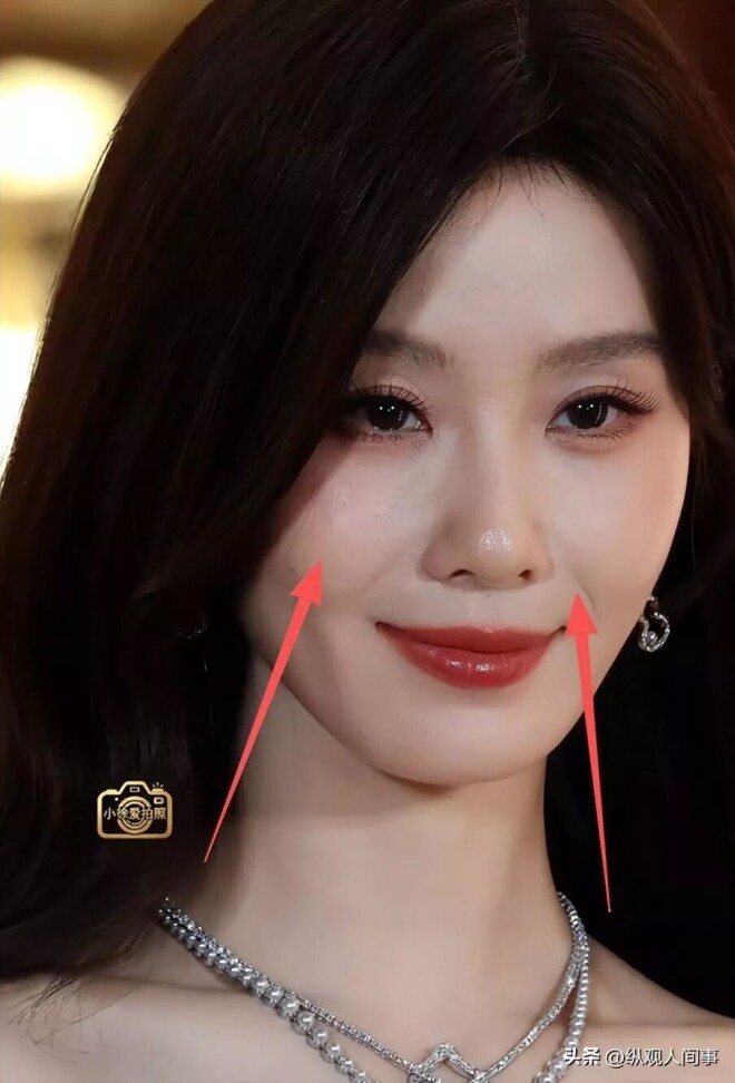 39岁刘诗诗近照曝光 脸颊无肉双眼无神睁不开（配图14）