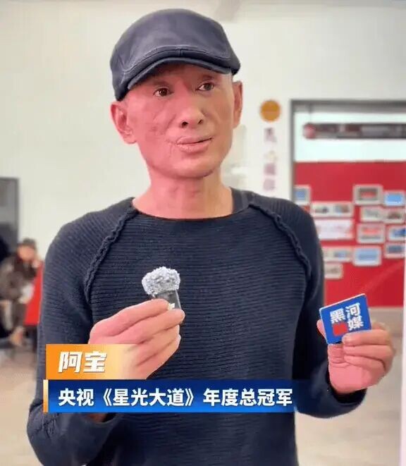 还记得《星光大道》阿宝吗？疑似被烧伤面容大变（配图1）