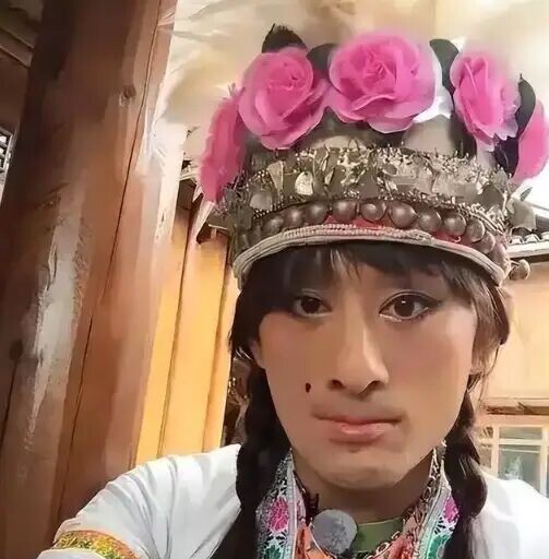 还记得《星光大道》阿宝吗？疑似被烧伤面容大变（配图6）
