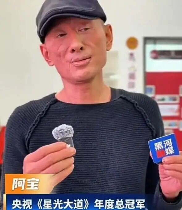还记得《星光大道》阿宝吗？疑似被烧伤面容大变（配图2）