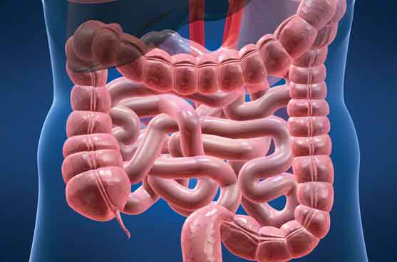 结肠直肠癌（大肠癌） | Quah Hak Mien Colorectal Centre