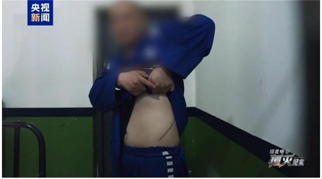 业绩差被割肾是真的！电诈受害者现身央视