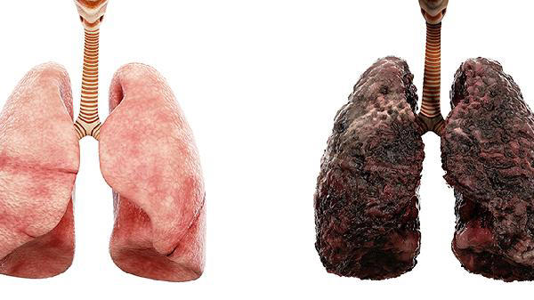研究57万人表明：肚子大、个子高的人患癌风险高