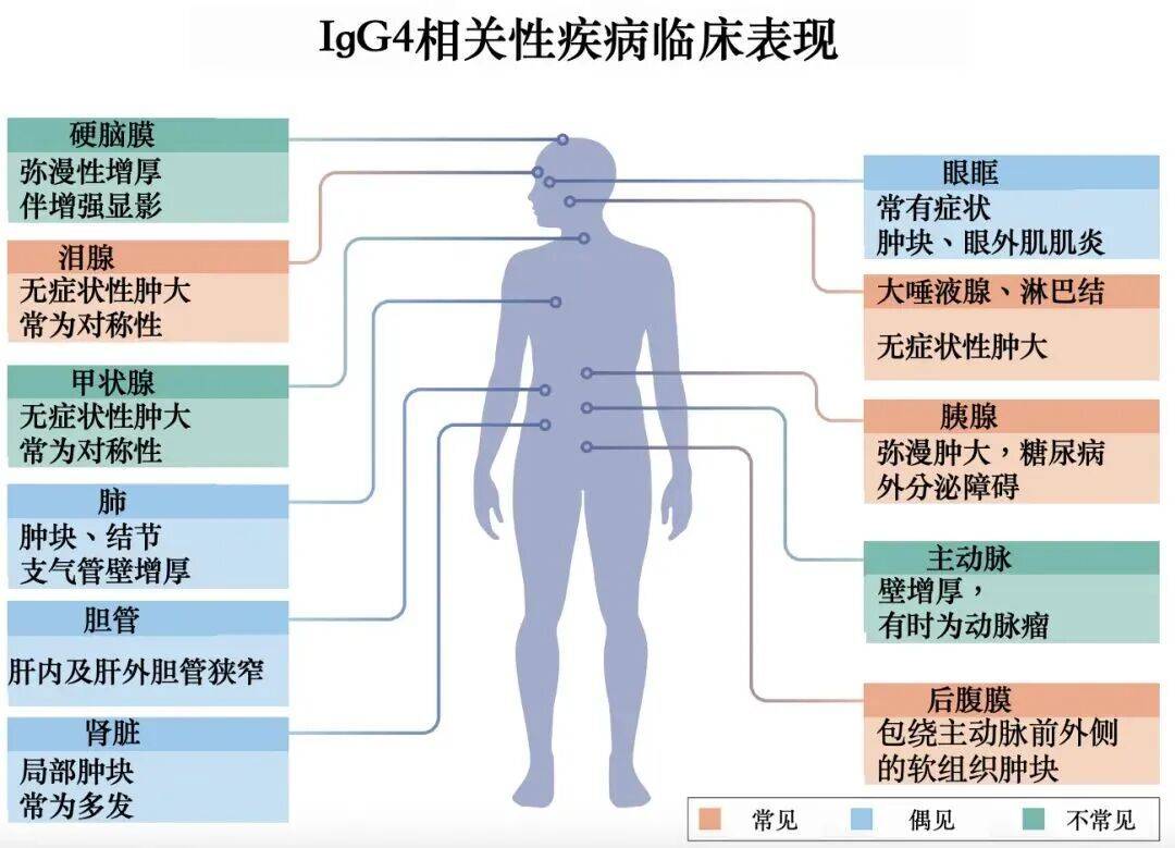 文章配图-2