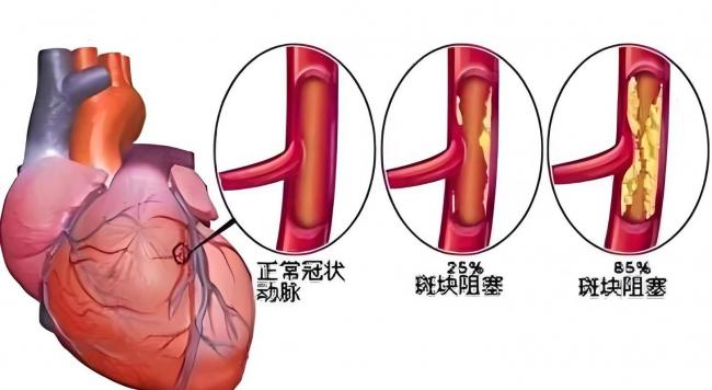 刘欢病逝，网传腹泻是致命一击