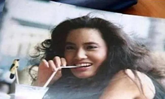 女星整容下狠手 头部取出一公斤液体物质
