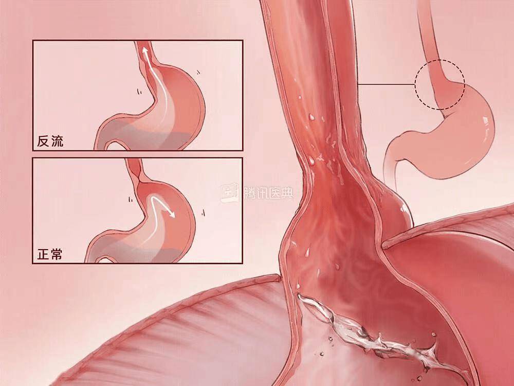 文章配图-4