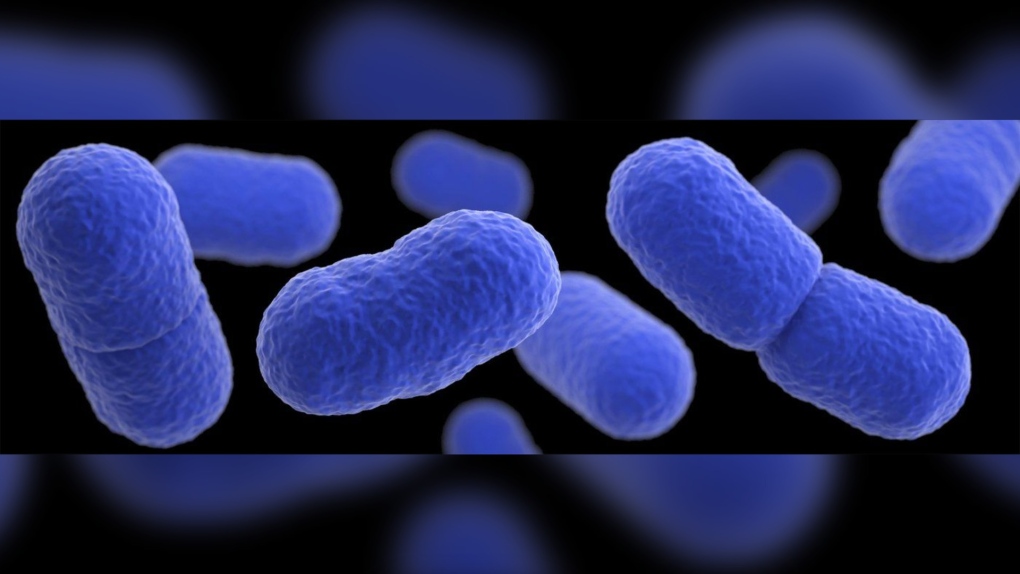 以下是有关与美国致命李斯特菌爆发有关的召回野猪头熟食的信息 ...