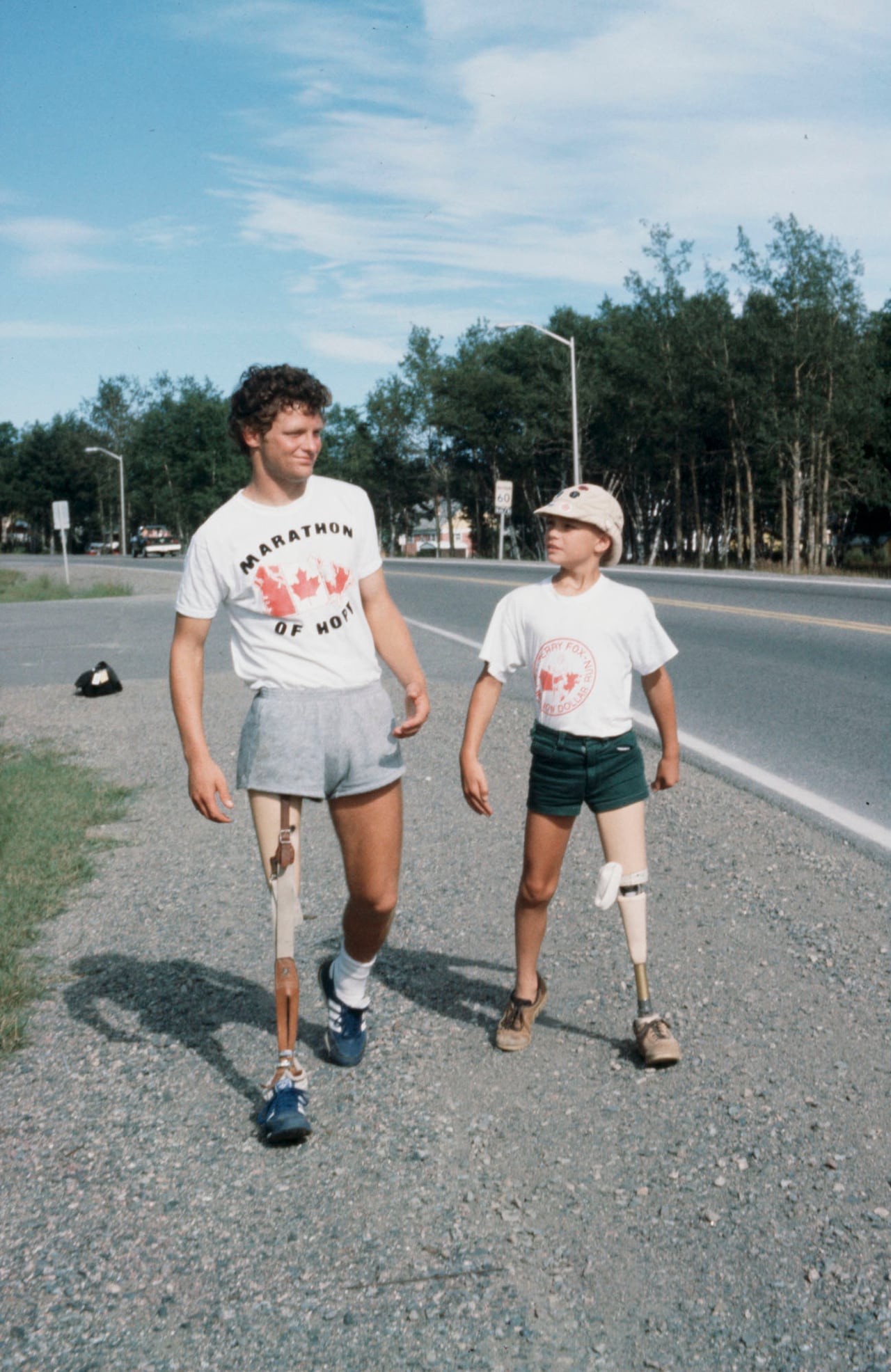 A man and boy with amputated legs.