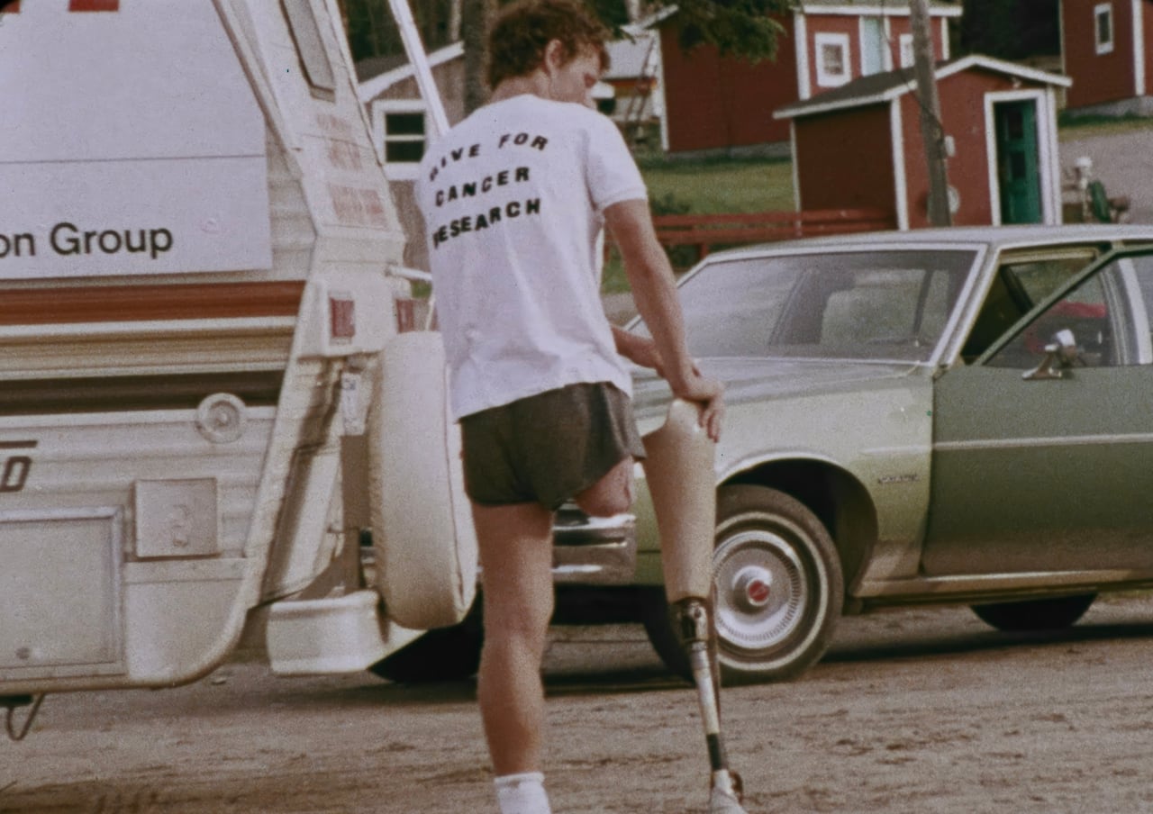 Man holds his prosthetic leg.