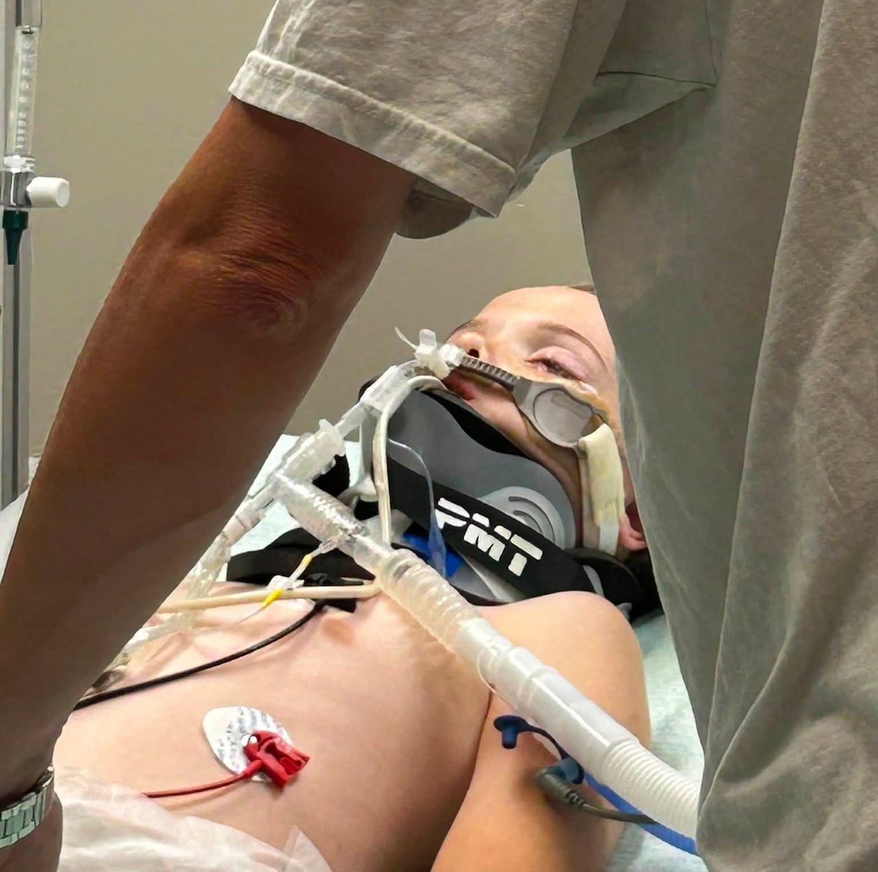A boy lies in a hospital bed, intubated and with a neck brace.
