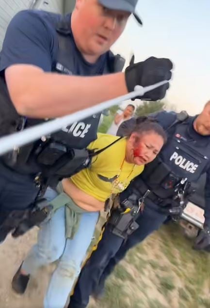Rose Angus被警方带走，面部受伤