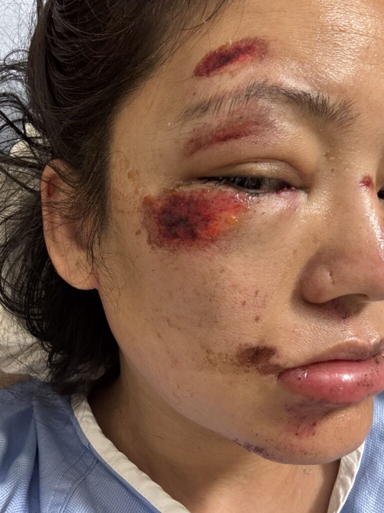 密市停车场争执酿伤害 一女子受伤入院警方调查中（配图2）